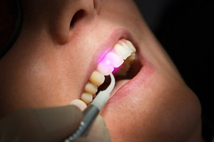Lasertherapie